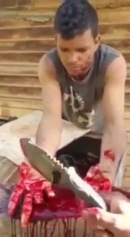 Two Men Get Their Fingers Cut Off