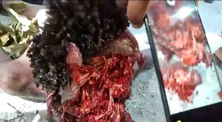 Hey! Come And See This Guys Blasted Out Skull