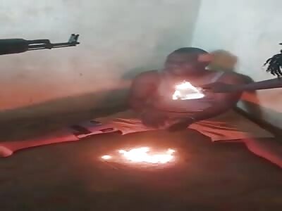 Man Gets Tortured With Melting Plastic At Gunpoint