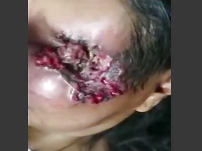 Yet another maggot infested skull