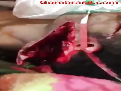 Man with deep cut on face