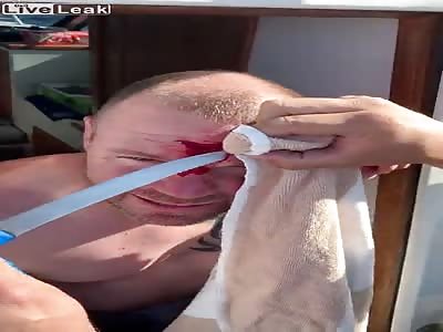 Fillet fish forehead