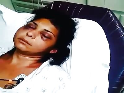 Aftermath of a Gypsy Girl getting beat up