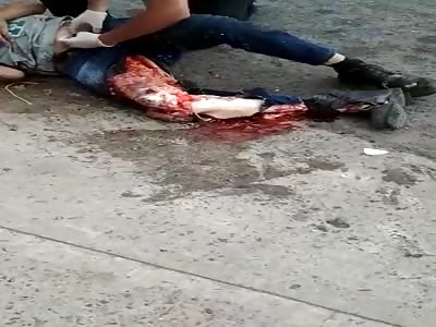 Just Look at His Leg