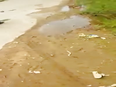 Boy I lost my foot in an accident.