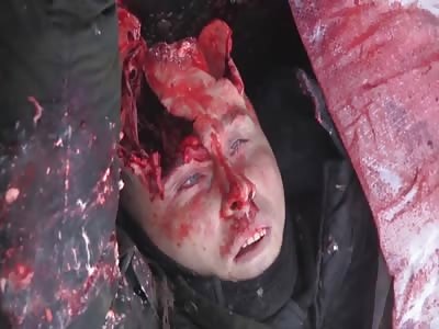 Dead soldiers in ukrania