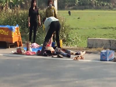 Woman suffers a serious accident