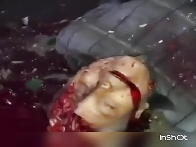 Ukrainean Artillery Victims, Lugansk., Video 