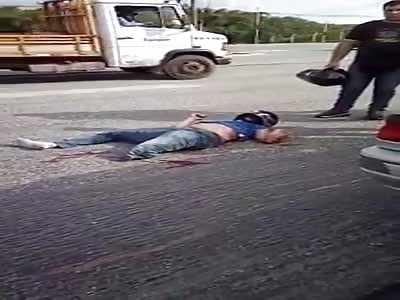 Motorcycle rider suffers serious accident