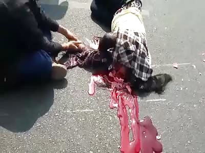 Woman loses her head in terrible accident.