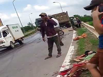 Motorcycle rider suffers serious accident