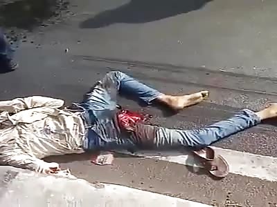 Accident with three men on high speed motorcycles all in Awkward Positions 