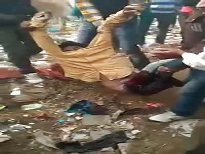 Accident train man lost leg..One Body Part at a Time