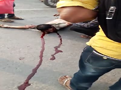 Man suffers a terrible accident and loses his arm