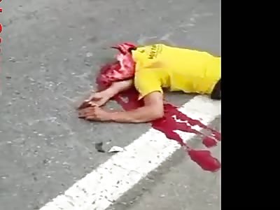 Motorcycle rider suffers serious accident