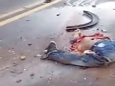 Man has body dismembered in accident