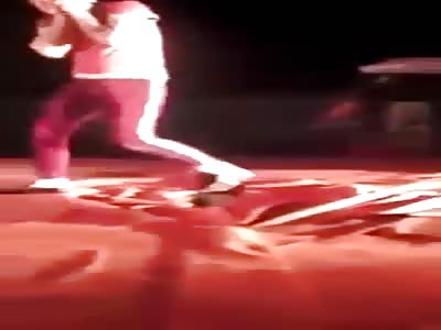 Crocodile disfigures face of man in circus pairing