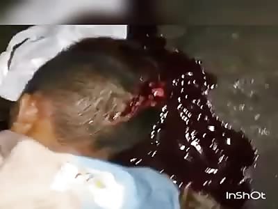 Young man dying to death after taking several shots on his head