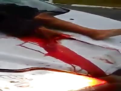 Man suffers a terrible accident and loses his leg