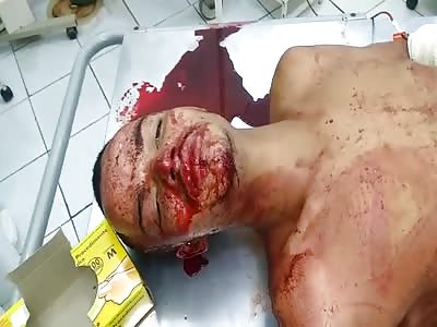 Police films agonizing drug dealer after shots