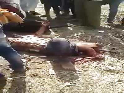 Man loses leg in accident in labor camp