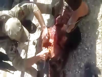 Soldier has open chest with knife