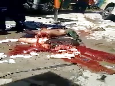 MAN CRUSHED BY TRUCK REMOVED WITH HOE