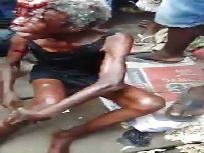 Old wounded among the people