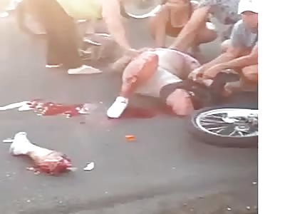 Motorcycle rider suffers serious accident