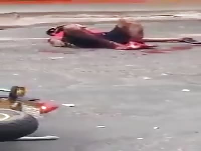 Motorcycle rider suffers serious accident