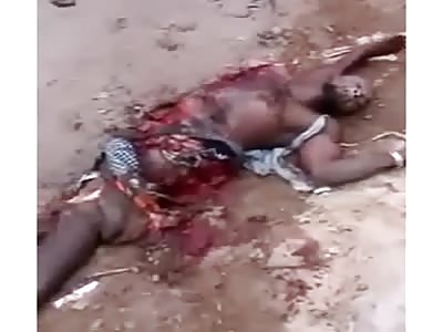 Horrible accident Man destroyed by truck and Still agonizing