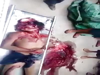 Head crash truck accident 