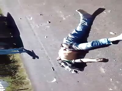 Motorcycle rider suffers serious accident