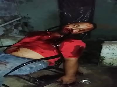 Man agonizing take several shot 