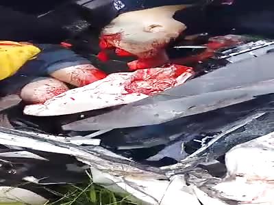 Agonizing after horrific accident 