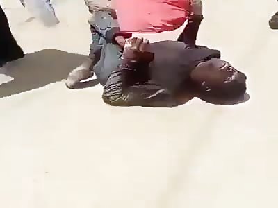 Man is born with terrible disease in the bones he is crawling