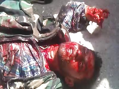 Shocking soldier agonizing last seconds with a shot in the neck