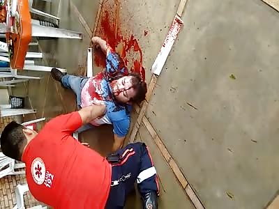 Man was shot in the head but the delay was delayed