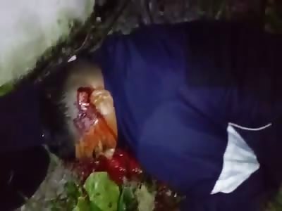 agonizing after get shot