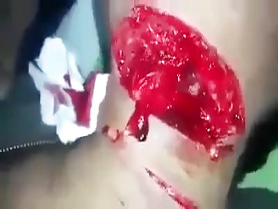 Very Gross Man Keeps Talking with His Neck Wild Open