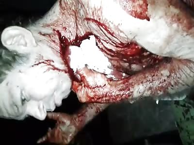 A man stabbed in the neck usually talks