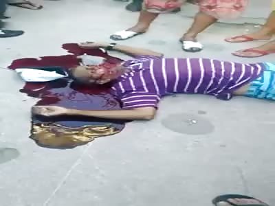 man get headshot an agonizing last minutes life 