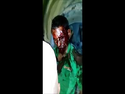 thief bus brutally beaten 