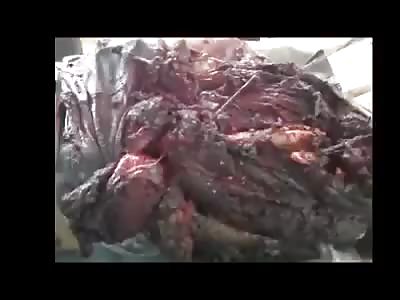 Man had his body shattered in war