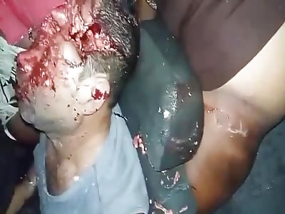 accident with sexy girls