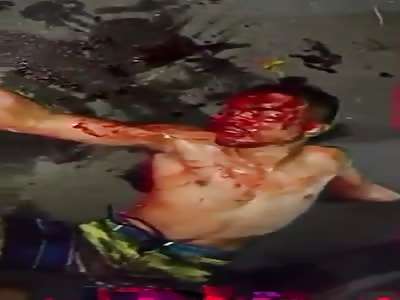 firefighter was a victim of assault and shot two bandits