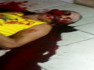 Agonizing after several shot on the face 