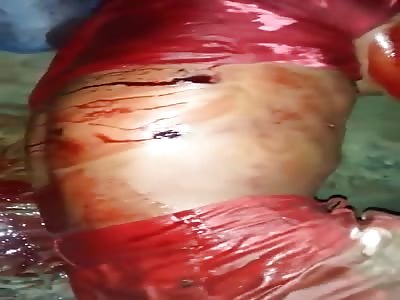 man all pierced with bullet of dying shots of pain waiting for help