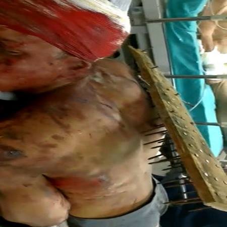(Other Angle)Thief gets a stick with nails buried in his back