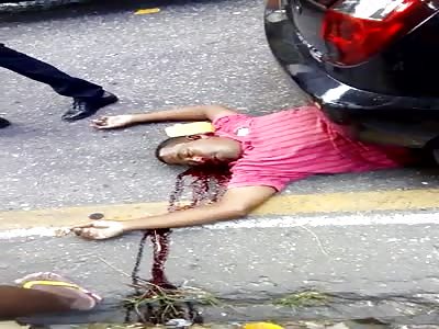 horrific accident ,man in horrific agony 